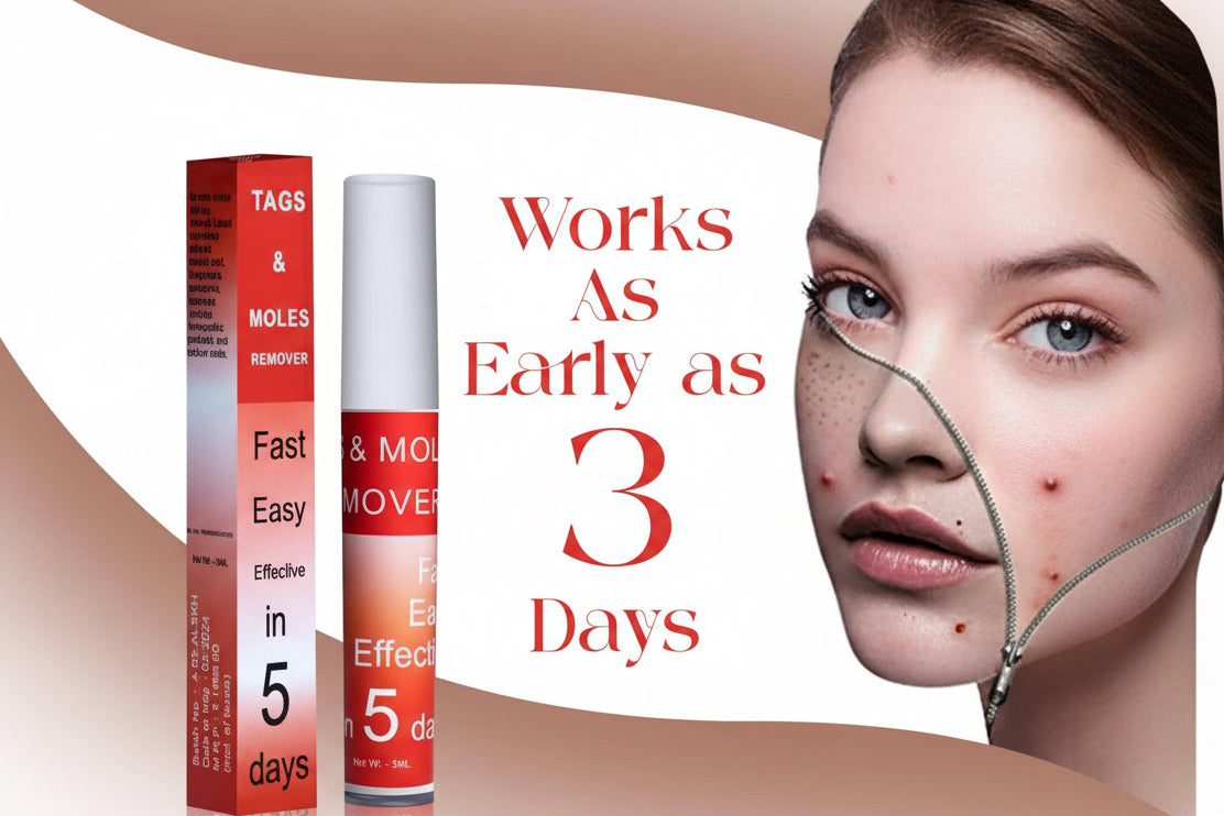 Tags & Moles Remover (Pack of 2)