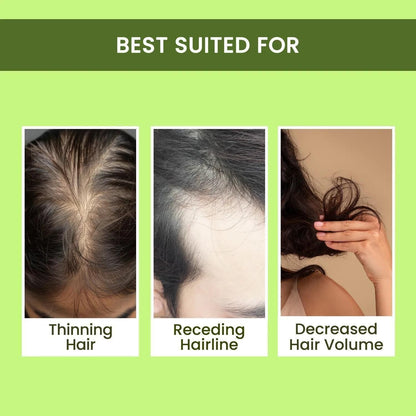 Feimee Rosemary Hair Water Spray (Buy 1 Get 2 Free)